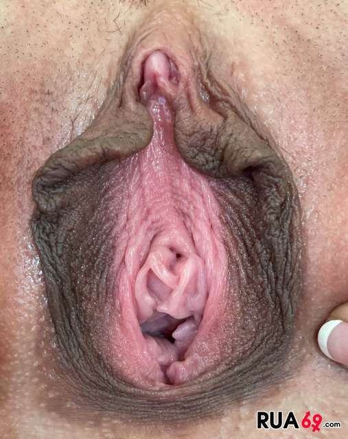 cLITORIS